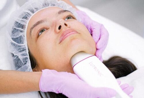 Laser Treatments for the Face