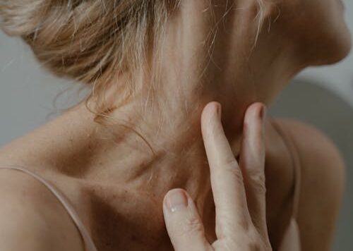 Neck and hand skin