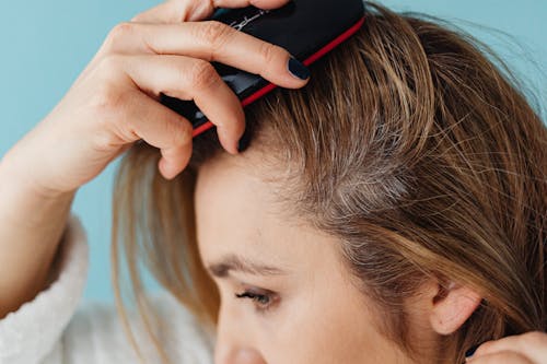 How to Treat Itchy Scalp