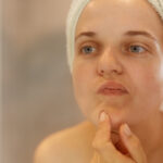 How to Hydrate and Soothe Dry, Sensitive Skin