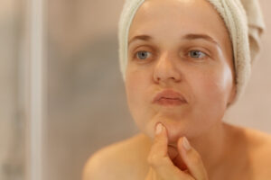 How to Hydrate and Soothe Dry, Sensitive Skin